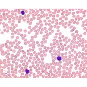 COLORANTE GIEMSA   500 ML.